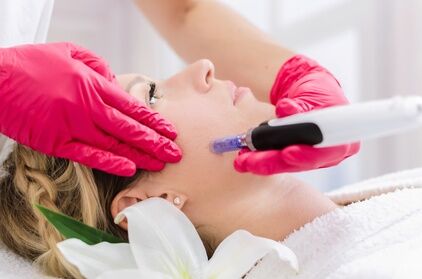 Santosha Natural Skincare 60 Min. Microneedling, Einschleusen von Hyaluron oder BB Glow bei Santosha Natural Skincare (bis zu 68% sparen*)