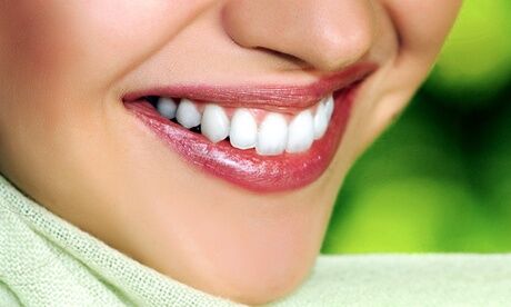 Bodyforming im Magni Kosmetisches Zahn-Bleaching bei Bodyforming im Magni (bis zu 66% sparen*)