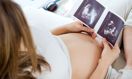 The Baby Ultrasound Clinic Wakefield 3D or 4D Ultrasound Baby Scan Package with Optional DVD at The Baby Ultrasound Clinic Wakefield (Up to 40% Off)