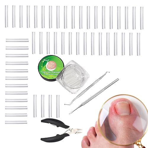 SKUDA Ingegroeide Nagel Corrector Tool Gebogen teennagelcorrector, nagelcorrectie C-vorm teennagelknipper,Met Ingegroeide Teennagel Lifter Gebogen Teennagel Corrector Voor Pedicure Tool