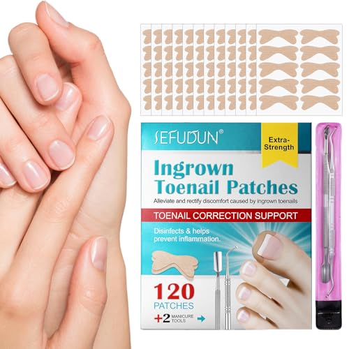 shizuku Correctiepatch voor teennagels, 120 STKS Teennagel Stijltang, Nagelcorrectiepleisters voor verlichting van ingegroeide teennagels thuis, geschikt voor alle nagelmaten