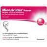 Minoxicutan Frauen 20 mg/ml Spray 3x60 ml Lösung