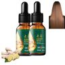 cookx 2024 New Hankey Anti-hair Loss Hair Serum,Old Ginger Hair Care Essence Oil,Old Ginger Hair Care Essence Oil 30ml,Hair Growth Serum,Ginger Oil for Hair Growth,Ginger Plant Extract Anti Hair Loss (2PCS)