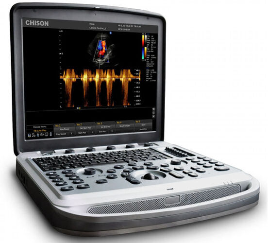 Ecógrafo portátil Chison Sonobook8