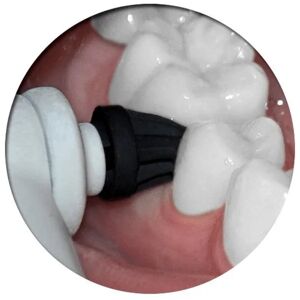 TheTrade Poler selv - Passer til OralB el-tandbørste - inkl. 2x2 gram polerpasta White