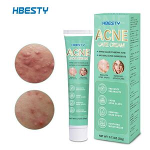 Keep Health Care Effective Acne Removal Cream Aloe Acne Spots Oil Control Anti-aging Moisturizing Whitening Acne Cream Treatment Skin Care 20g