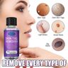 Maidou 30ml Skin Tag Removal, Wart Mole Remover, Skin Tag Removal Natural Repair Serum,