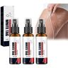 ARTEBU Vitiligo Relief Spray, Psoriasis Relief Spray, Psoriasis Control Face and Body Cream, Soothing and Moisturizing Reduce White Spots Cream for All Skin Types