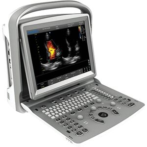 Chison Colordoppler Chison Eco 6 Portatile