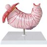 MUSUMI Educatief model Maag anatomisch model Gastritismodel Maaglaesiemodel Maagpathologie Gastritiszweermodel Anatomiemodel van menselijk orgaan
