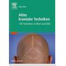 Alian Gehin - Atlas kranialer Techniken: 100 Techniken in Wort und Bild - Preis vom 17.06.2024 04:58:58 h