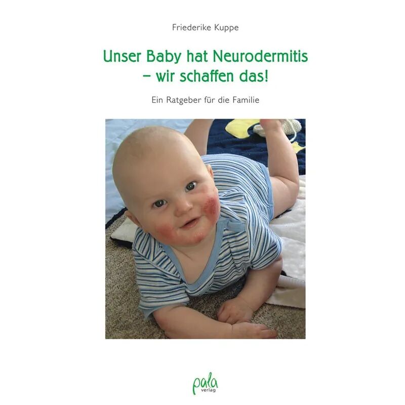 Pala-Verlag Unser Baby hat Neurodermitis - wir schaffen das!