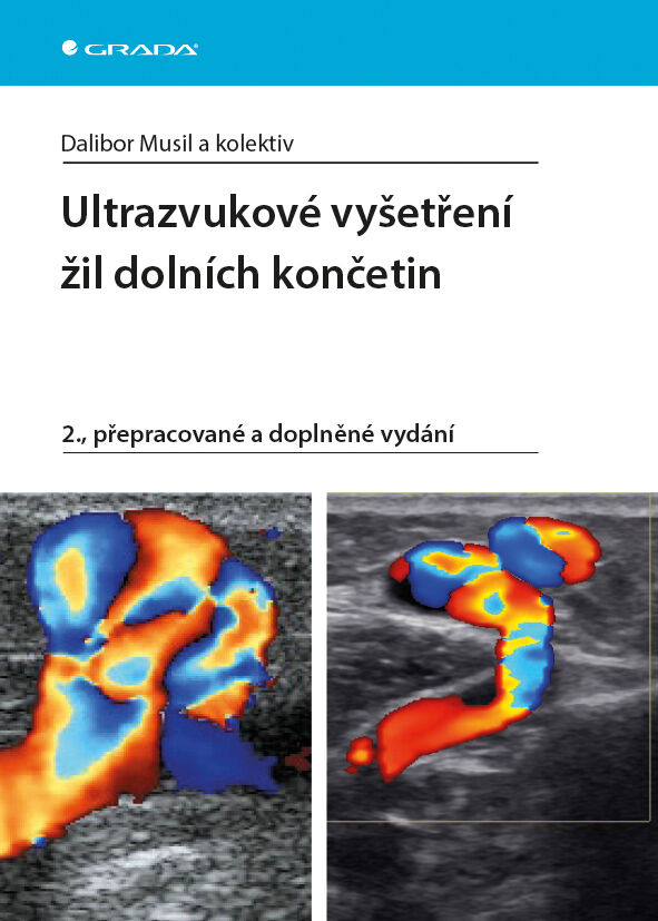 Grada Ultrazvukové vyšetření žil dolních končaetin, Musil Dalibor