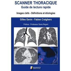 GEBRAUCHT SCANNER THORACIQUE. GUIDE DE LECTURE RAPIDE: IMAGE CELFS. DEFINITION ET ETIOLOGIES (RADIOLOGIE) - Preis vom h