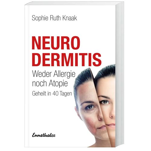 Ennsthaler Neurodermitis – Sophie R. Knaak, Kartoniert (TB)