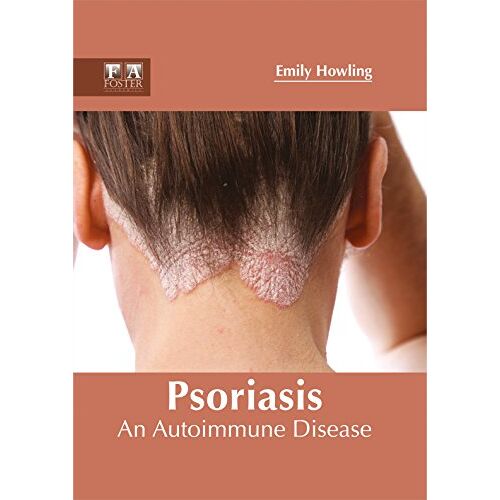 Emily Howling – Psoriasis: An Autoimmune Disease