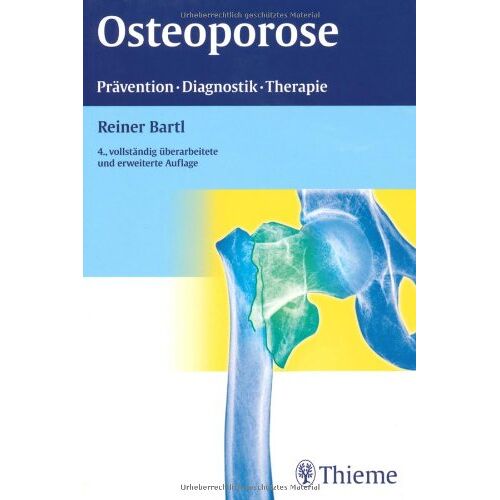 Reiner Bartl – GEBRAUCHT Osteoporose: Prävention – Diagnostik – Therapie – Preis vom 20.12.2023 05:52:08 h