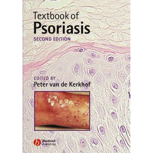 Van De Kerkhof, Peter C. M. – GEBRAUCHT POP UP-TEXTBK OF PSORIASIS REV – Preis vom 20.12.2023 05:52:08 h