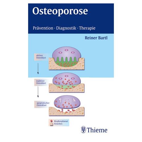 Reiner Bartl – GEBRAUCHT Osteoporose. Prävention-Diagnostik-Therapie – Preis vom 20.12.2023 05:52:08 h