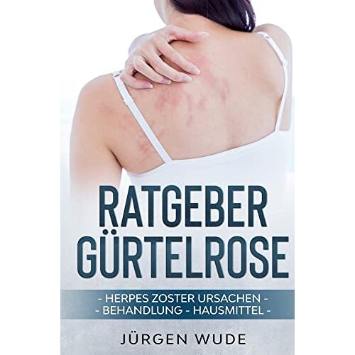 Jürgen Wude – Ratgeber Gürtelrose: Herpes Zoster Ursachen Behandlung Hausmittel