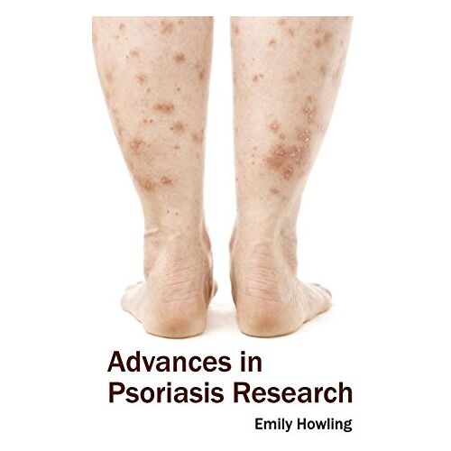 Emily Howling – Advances in Psoriasis Research