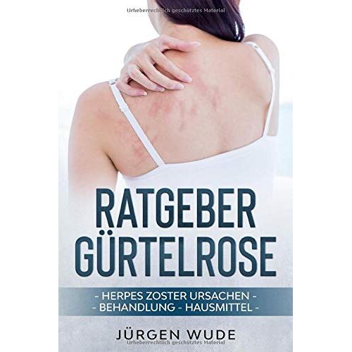 Jürgen Wude – GEBRAUCHT Ratgeber Gürtelrose: Herpes Zoster Ursachen Behandlung Hausmittel – Preis vom 20.12.2023 05:52:08 h