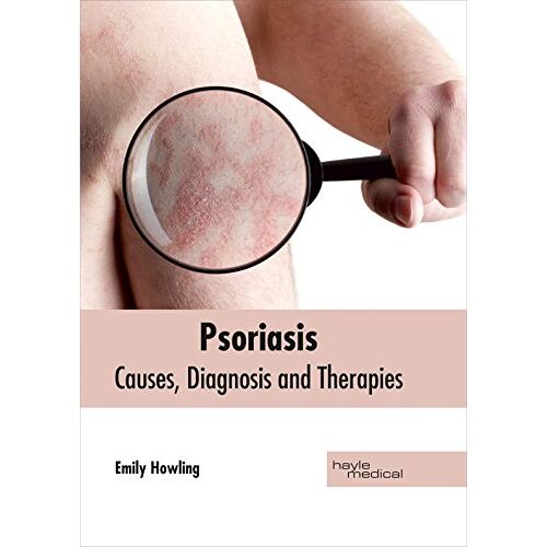 Emily Howling – Psoriasis: Causes, Diagnosis and Therapies