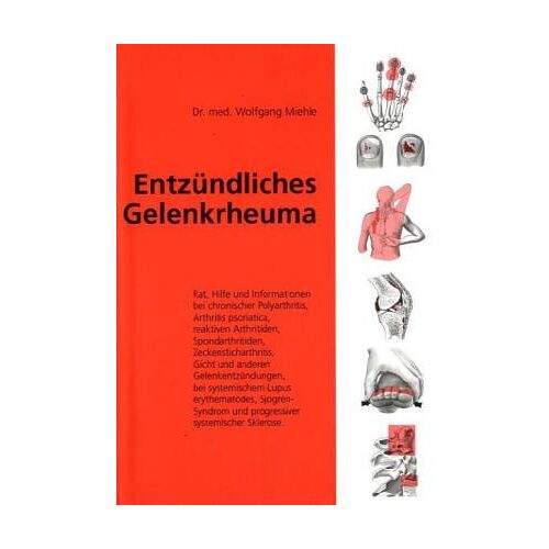 Wolfgang Miehle – GEBRAUCHT Entzündliches Gelenkrheuma. Rat, Hilfe und Informationen – Preis vom 08.01.2024 05:55:10 h