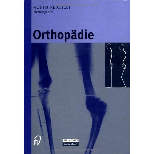 Achim Reichelt – Orthopädie