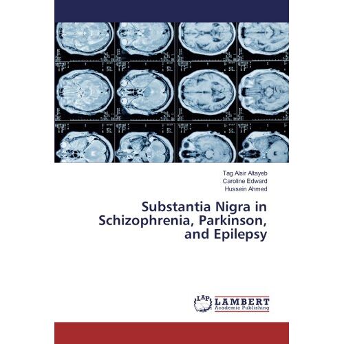 Altayeb, Tag Alsir – Substantia Nigra in Schizophrenia, Parkinson, and Epilepsy