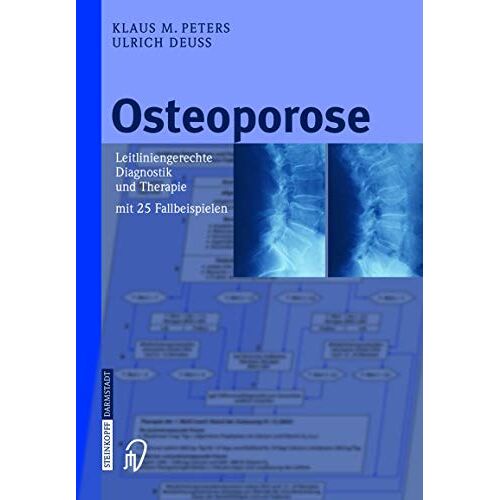 Peters, Klaus M. – GEBRAUCHT Osteoporose: Leitliniengerechte Diagnostik und Therapie mit 25 Fallbeispielen – Preis vom 20.12.2023 05:52:08 h