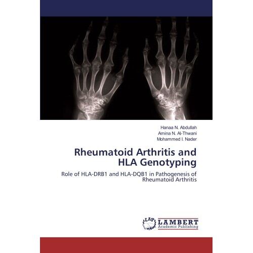 Abdullah, Hanaa N. – Rheumatoid Arthritis and HLA Genotyping: Role of HLA-DRB1 and HLA-DQB1 in Pathogenesis of Rheumatoid Arthritis