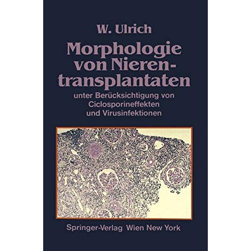 Ulrich Walter – Morphologie von Nierentransplantaten: Unter Berücksichtigung Von Ciclosporineffekten Und Virusinfektionen