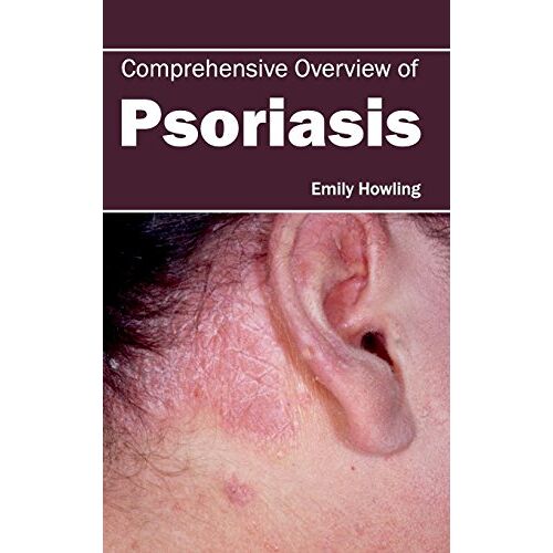 Emily Howling – Comprehensive Overview of Psoriasis