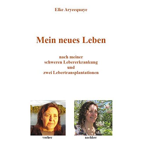 Elke Aryeequaye – GEBRAUCHT Mein neues Leben: nach meiner schweren Lebererkrankung und zwei Lebertransplantationen – Preis vom 20.12.2023 05:52:08 h