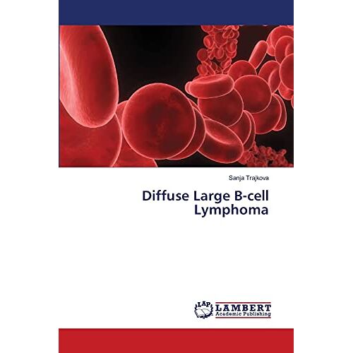 Sanja Trajkova – Diffuse Large B-cell Lymphoma