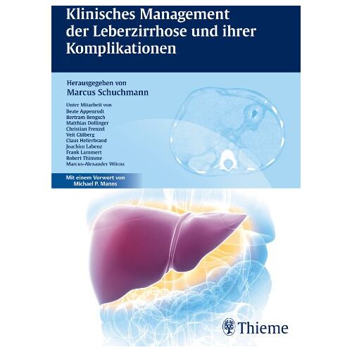 Marcus Schuchmann – GEBRAUCHT Klinisches Management der Leberzirrhose und ihrer Komplikationen – Preis vom 08.01.2024 05:55:10 h