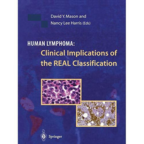 Mason, David Y. – Human Lymphoma: Clinical Implications of the REAL Classification