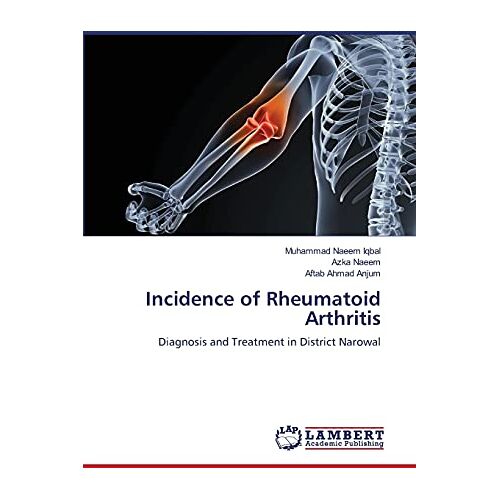 Iqbal, Muhammad Naeem – Incidence of Rheumatoid Arthritis: Diagnosis and Treatment in District Narowal