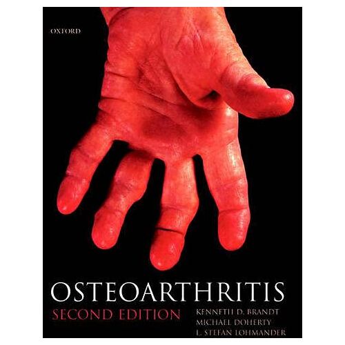 Brandt, Kenneth D. – GEBRAUCHT Osteoarthritis (Oxford Medical Publications) – Preis vom 08.01.2024 05:55:10 h