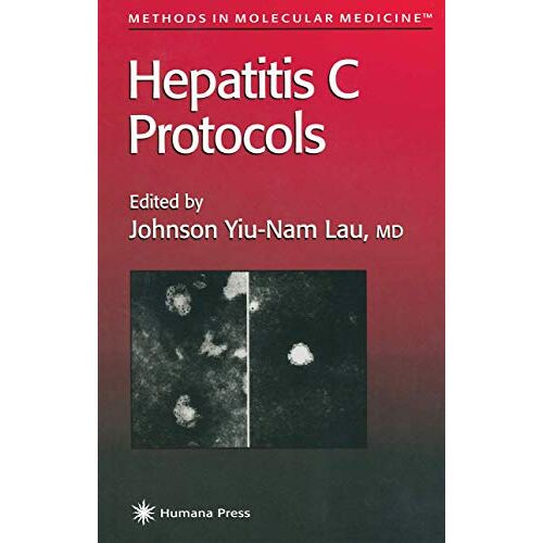 Lau, Johnson Yiu-Nam – Hepatitis C Protocols (Methods in Molecular Medicine) (Methods in Molecular Medicine, 19, Band 19)