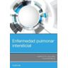 Elsevier España, S.L.U. Enfermedad Pulmonar Intersticial