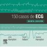 Elsevier 150 Casos De Ecg