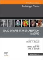 Elsevier Health Sciences Solid Organ Transplantation Imaging, An Issue Of Radiologic Clinics Of North America