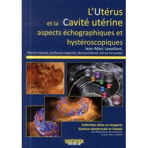 Luterus et la cavite uterine aspects echographiques et hysteroscopiques levaillant col Sauramps medical