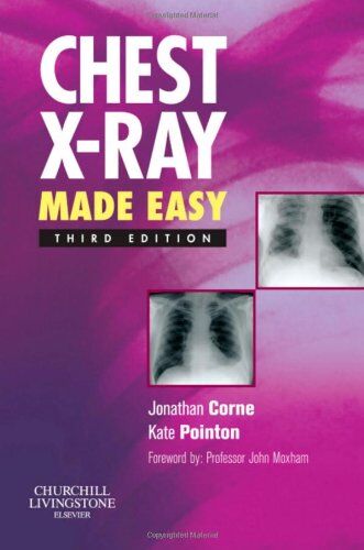 Jonathan Corne Chest X-Ray Made Easy (Made Easy (Churchill Livingstone))