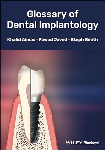 Glossary Of Dental Implantology