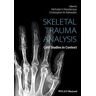 Skeletal Trauma Analysis