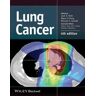 Lung Cancer