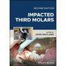 Impacted Third Molars